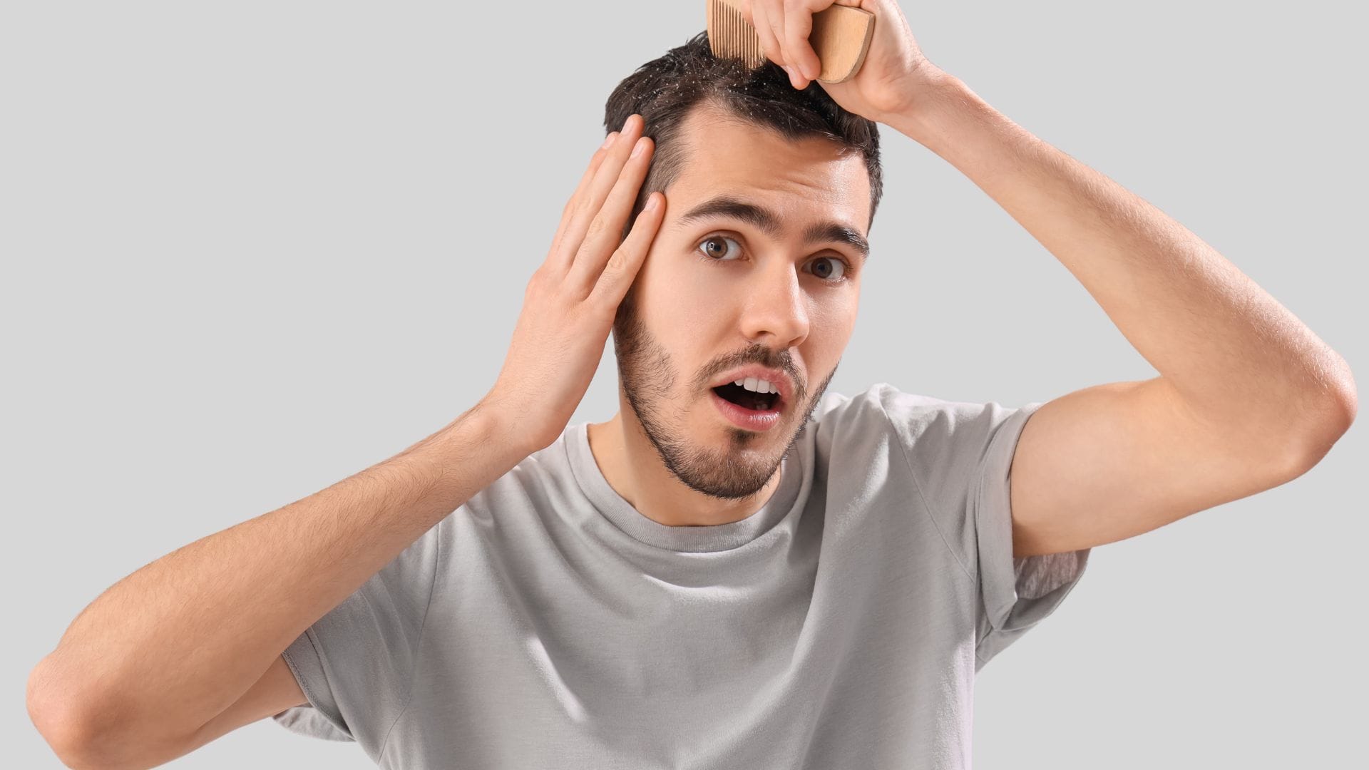 10 Solutions for Men with Dandruff