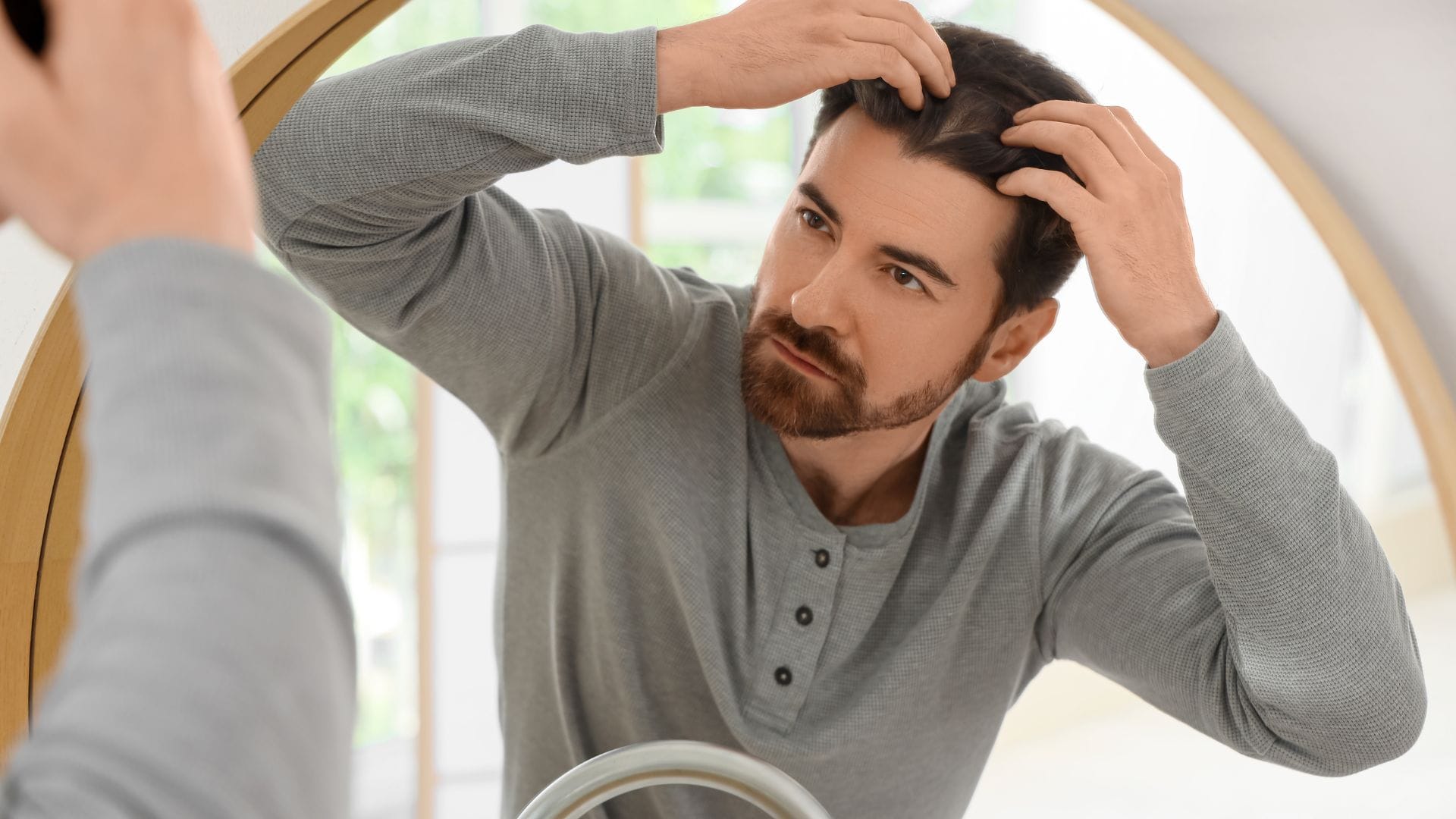 10 Strategies to Prevent Hair Loss Naturally