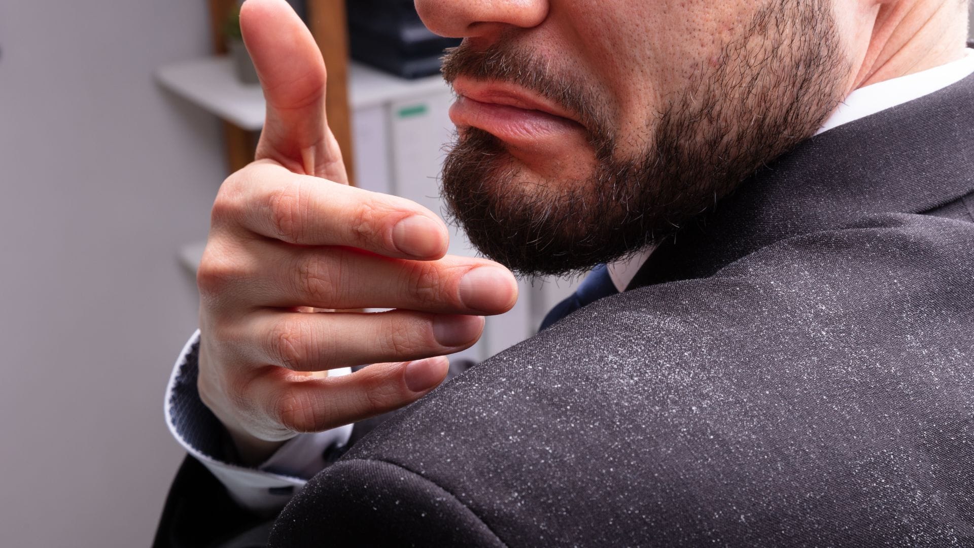 10 Ways to Treat and Prevent Dandruff