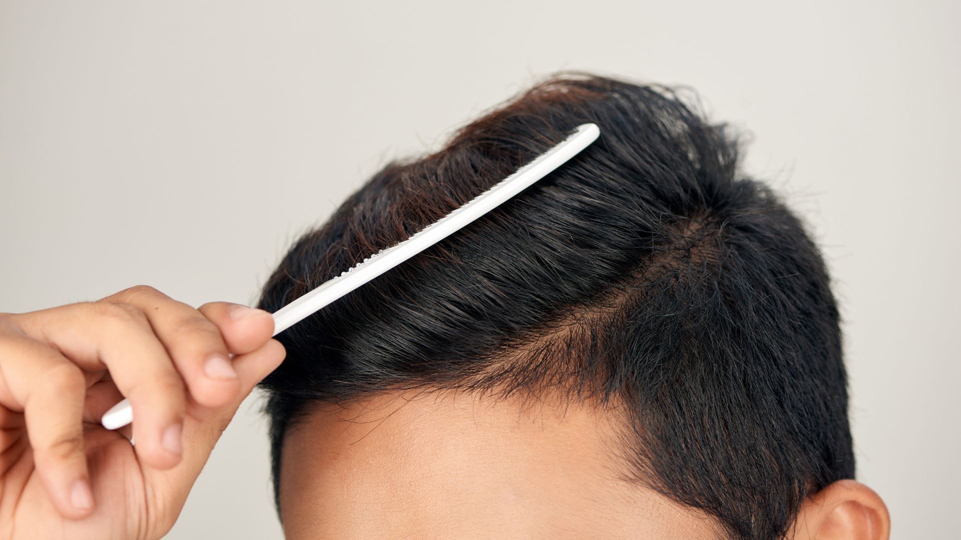 12 Tips for Maintaining a Healthy Scalp